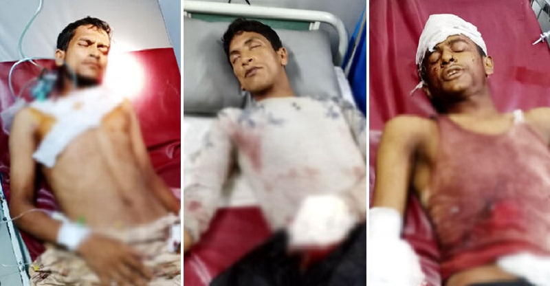 রোহিঙ্গাদের গুলিতে গুলিবিদ্ধ ৩ ভাই